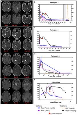 Perplexing paradoxical reactions: navigating the complexity of protracted tuberculosis meningitis—a case report